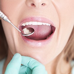 Zubný kaz treba liečiť včas
